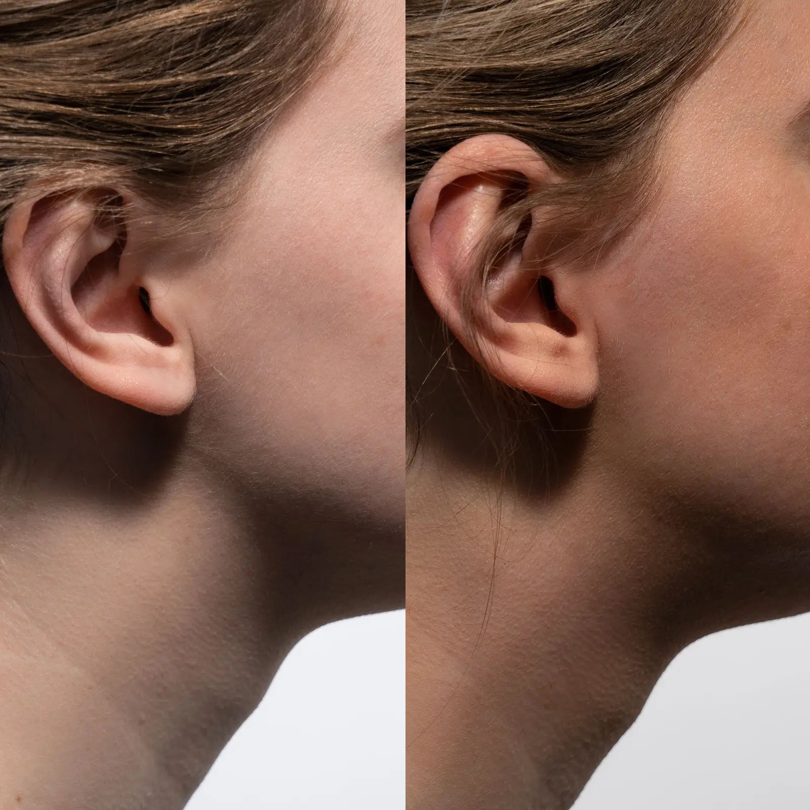 Melanotan II – 10mg